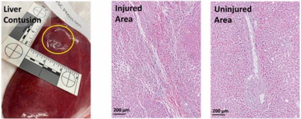 最新教你“哥哥跑得快开挂神器”详细开挂玩法