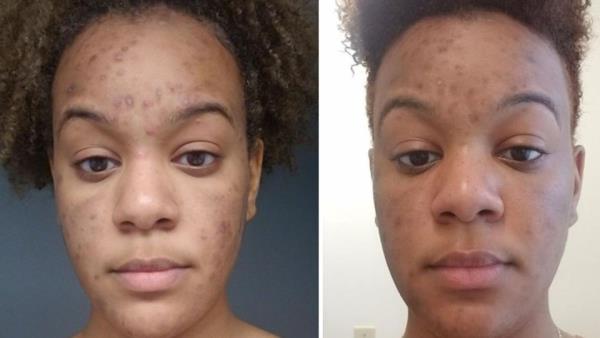 1分钟了解!微信拼三张透视挂-链接找谁买-